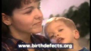 Birth Defect Research For Children